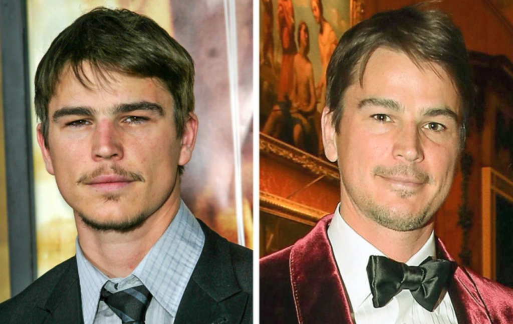 The Transformation of 14 Handsome Men Who Captivated Us in the 2000s